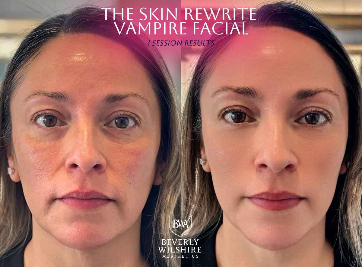 Beverly Wilshire Aesthetics Beverly Hills Medical Spa - Beverly Hills, CA