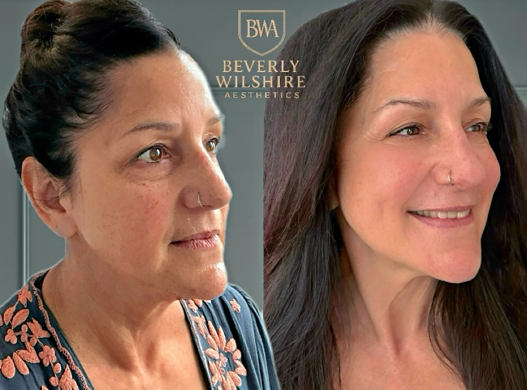 Beverly Wilshire Aesthetics Beverly Hills Medical Spa